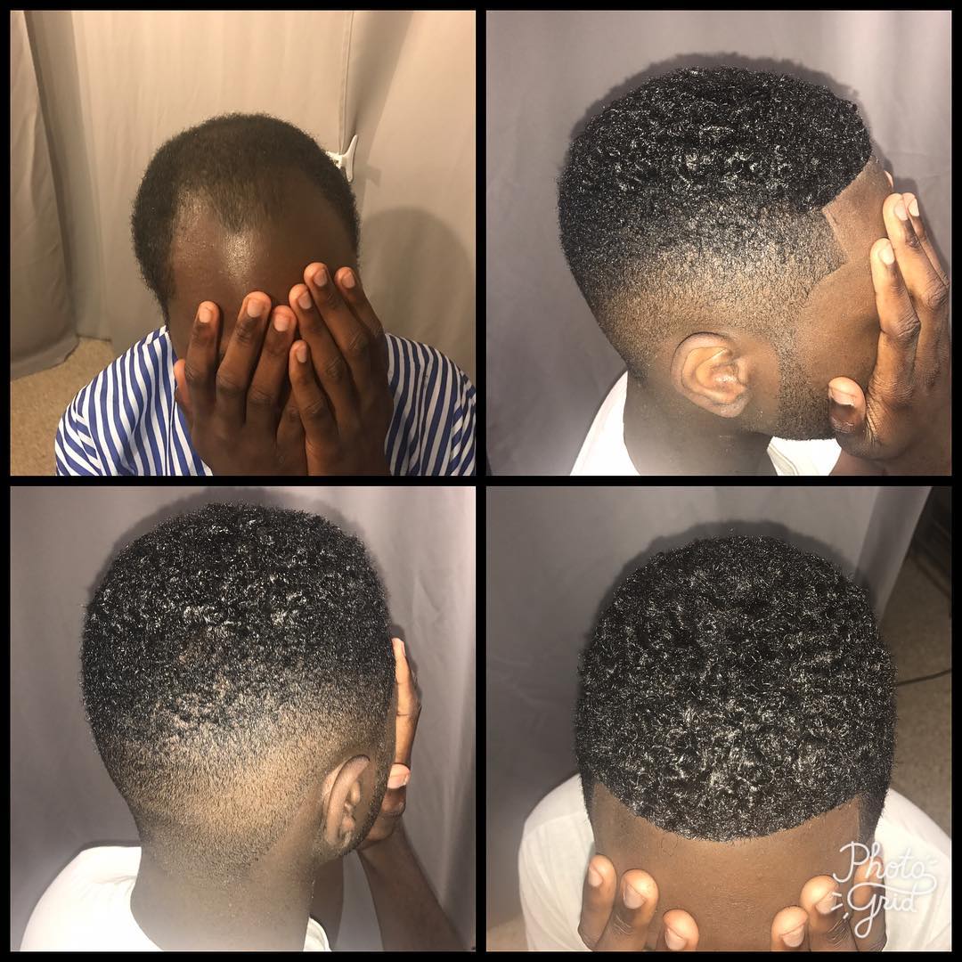 The Way to Solve The Thinning Hair for Black Male